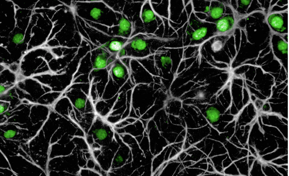 Cellectricon-announce-opportunity-discovery-differentiated-therapeutics-Alzheimer-Parkinson-diseases